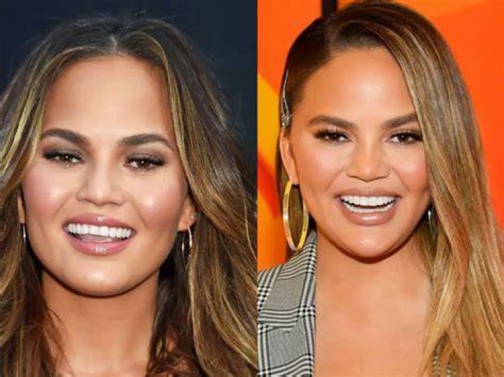 Chrissy Teigen Just Explained Why She Shared Photos of the Son She Lost