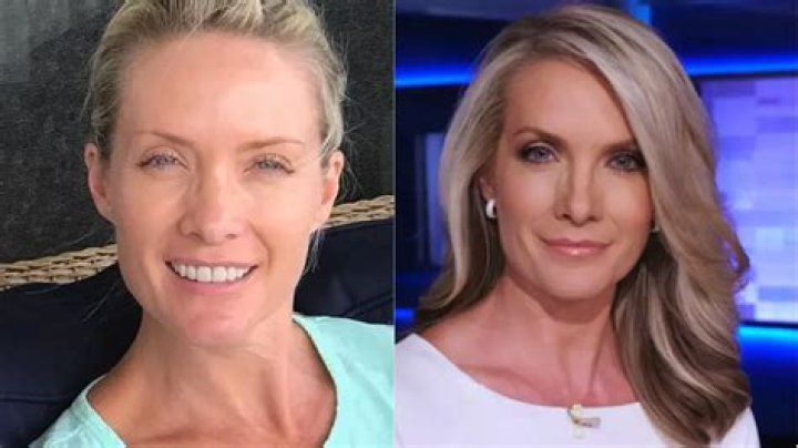Facelift, Botox, Fillers, Blepharoplasty, Nose Job; The Five Co-host Before & After Pictures Examined!