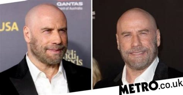 Is John Travolta Bald?