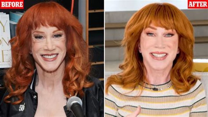Kathy Griffin Reveals Most Shocking Thing About Lung Cancer Diagnosis