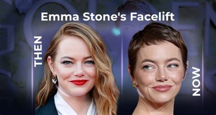 What Did Emma Stone Do Before She Was Famous?