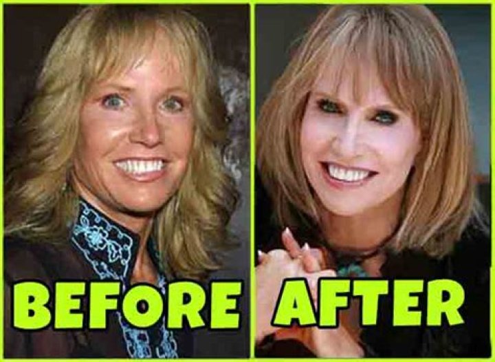 What happened to Monica Quartermaine (Leslie Charleson) on General Hospital? Know Her Age, Net Worth.