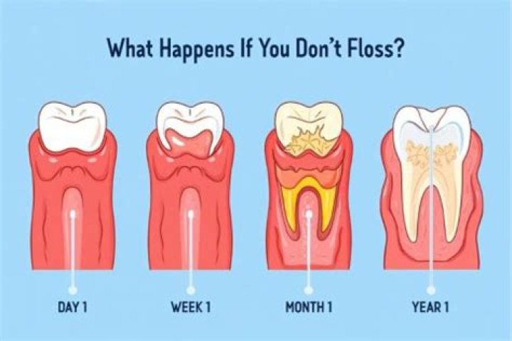 What Happens If You Don't Floss Your Teeth Every Night, According to Dentists