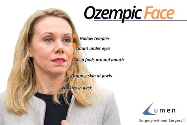 Women Report New Surprising Ozempic Side Effects: "Your Body Is Going to Change"
